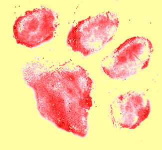 @playlist artwork