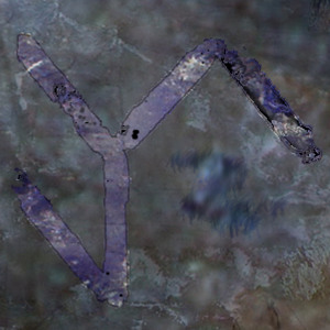 @playlist artwork