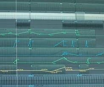 Track artwork