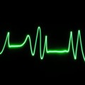 Heart Beat