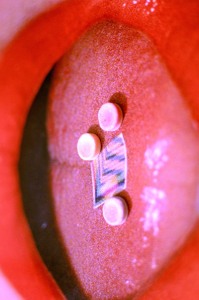 Track artwork