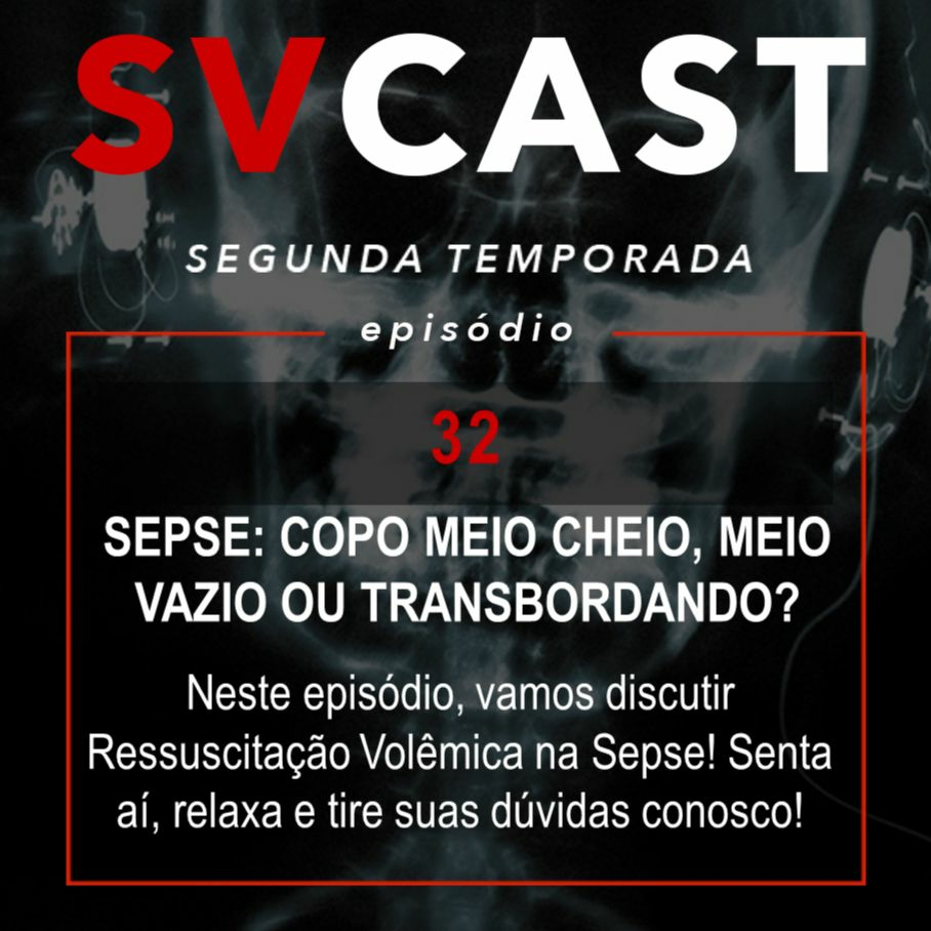 SVCast