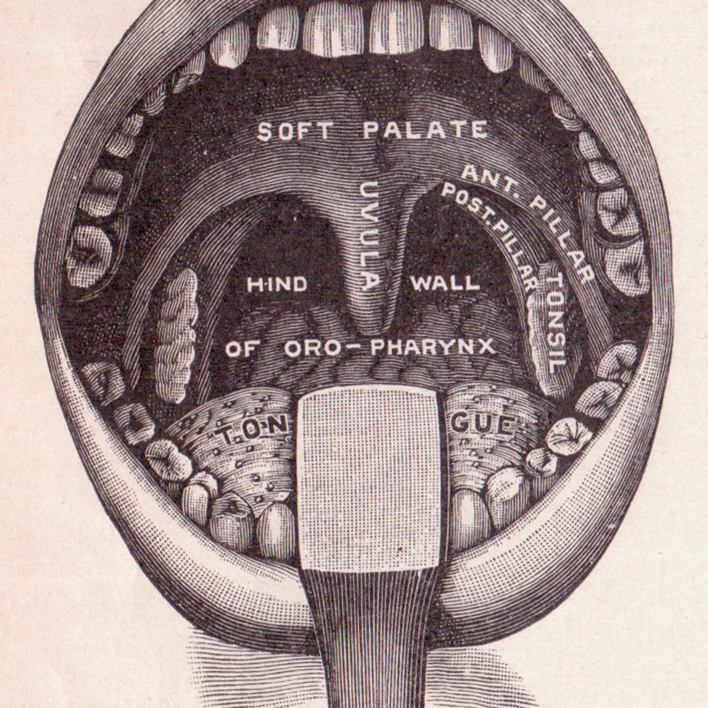 Episode 5:Teeth Are A Luxury