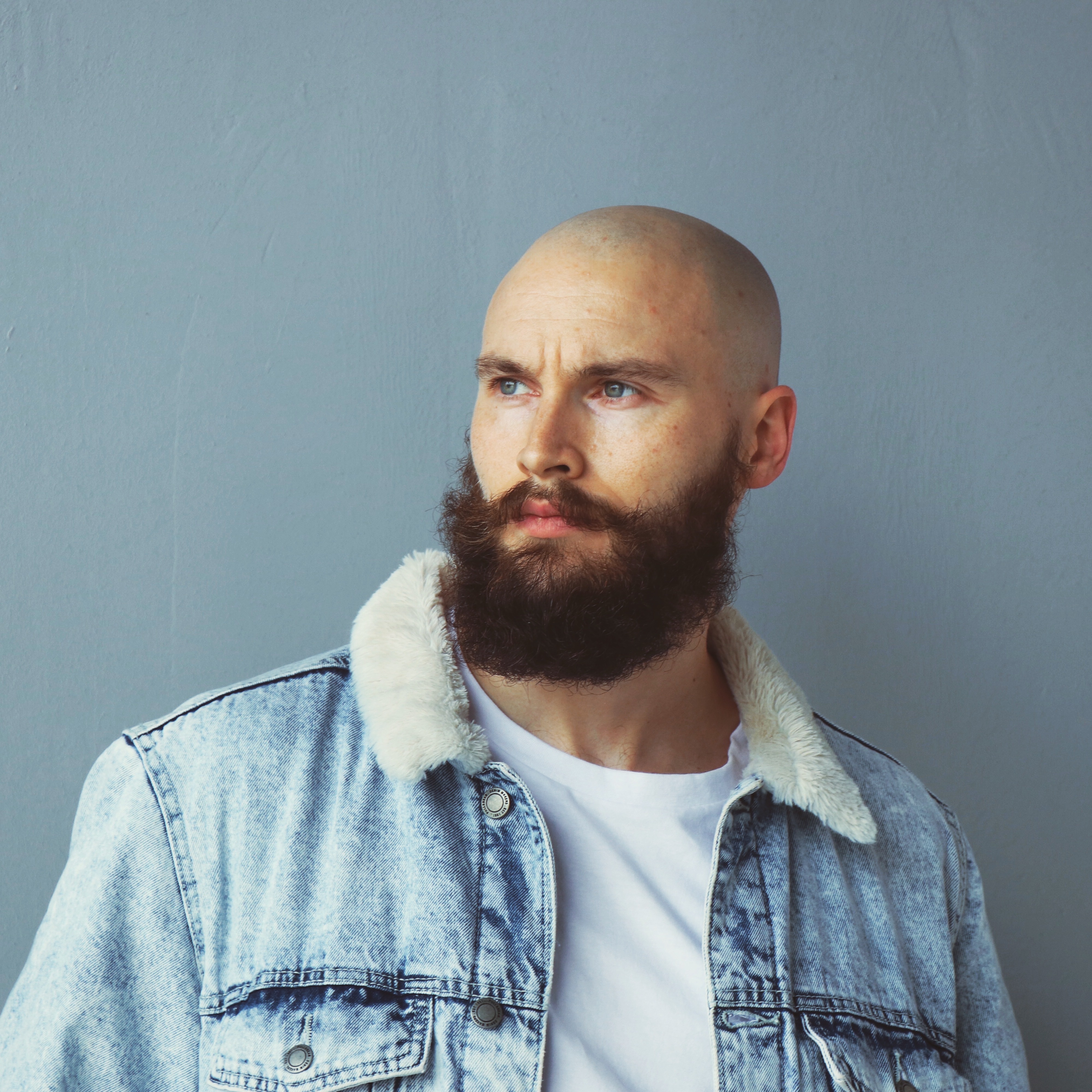GOING BALD YOUNG - *HAIR LOSS IS AN EXCUSE*