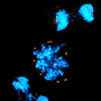 Finding differences in cancer cells and normal cells that can be exploited