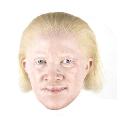Negritud Albina