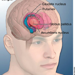 Tourette