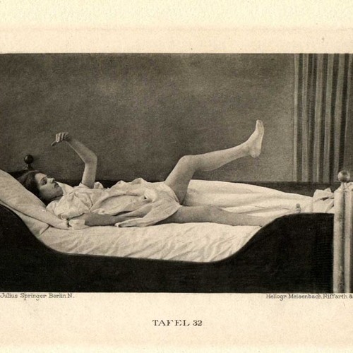 Шизофрения губы