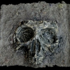 Extrasystole.henri death