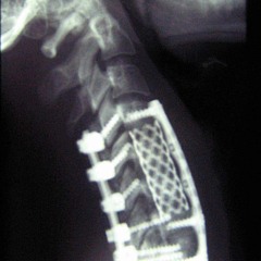 "after..." - 'cOntrOl frEQ.'