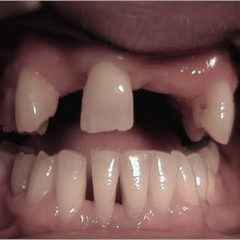 Ledezma & Tonic - Yuca (Original Mix) Free Download!!!!!