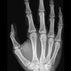 KornLike (Kornucopia)