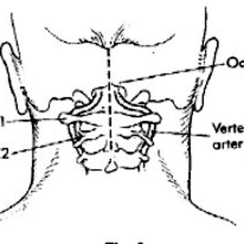 Occiput (Cociliana  Version)