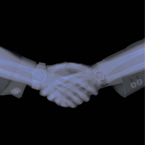 RONNY & RENZO - BROKEN FINGERS