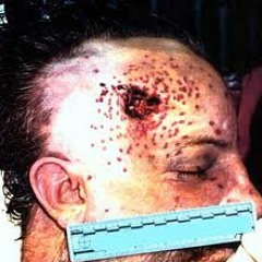 KG DA KID - SHOOT TO KILL (SNIPPET)