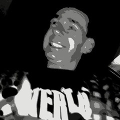 Nitrous Oxide – Follow You feat. Aneym (P...k.... Crazy Vision Remix)