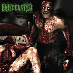 Eviscerated - Rectal Trauma