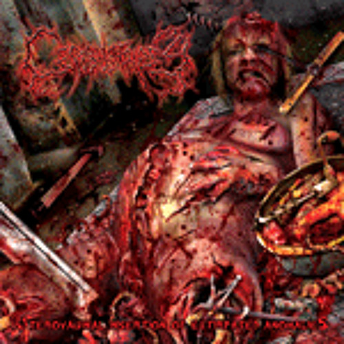 Cephalotripsy - Intracranial Butchery