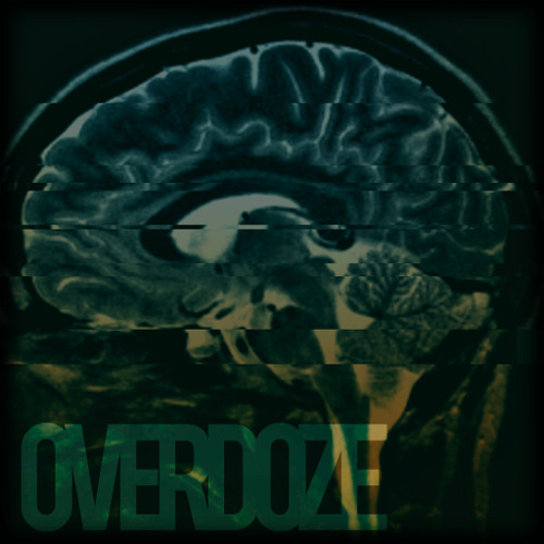 Urban Pulse - Overdoze