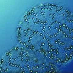 Sulpher Pearl of Numibia