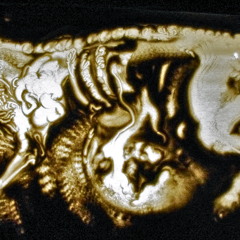 01.Twisted Kala - Psyche Mind  150 bpm