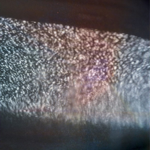 Clams casino crystals sample