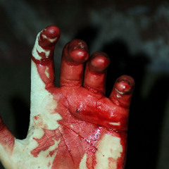 جرح الزهراء وجرح البحرين