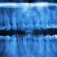 la dentatura
