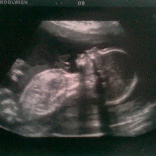 Ceren - Binary Baby