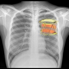 Drum In Your Chest [EC Twins & Remy Le Duc remix]