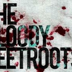 Bloody Beetroots - Warp 1977 (Disturbed. edit)