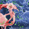 Patient Zero The Origin Of Aids Mp3