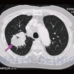 DJTEN’sVital sign(onSONG)/Clammbon