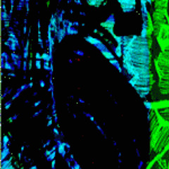 The bloody freeway tires of aminoglycoside ototoxicity