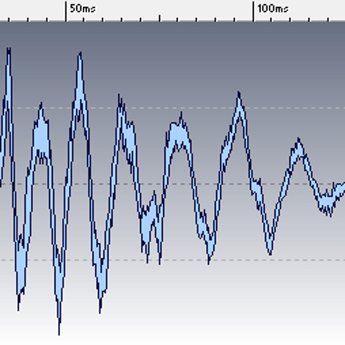 Fedde Le Grand "Put Your Hands Up For Detroit" - Snare [Sample]