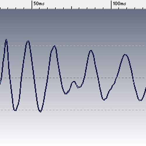 Bodyrox "Yeah Yeah" - Kick [Sample]