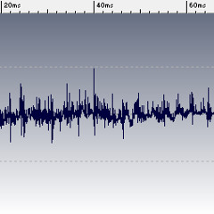 Bodyrox "Yeah Yeah" - High-hat [Sample]