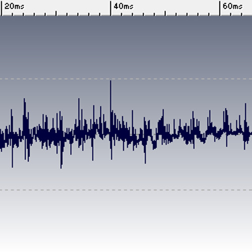 Bodyrox "Yeah Yeah" - High-hat [Sample]