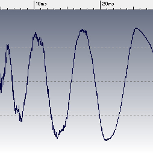 Dada Life "Happy Violence" - Kick [Sample]