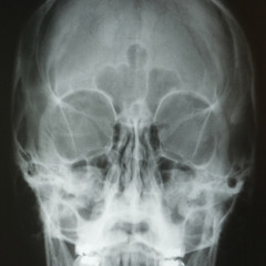 Anco. La Purga sin elección