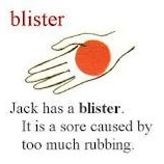 Blisters