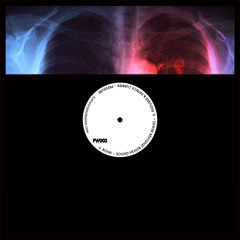 Bonk - Sound Healer (Enduser Remix) (FW003)
