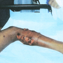 (KONG) Bite is bigger than its bark ... if you want this track for free read decription