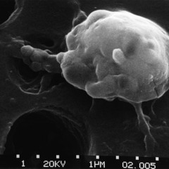 Apoptosis