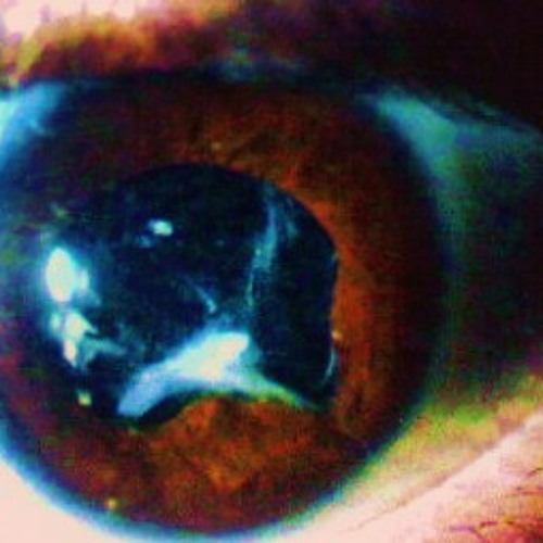 brian lind and others