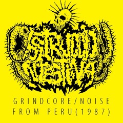 Obstruccion Intestinal