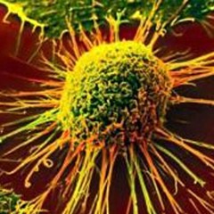 Biologic Cancer