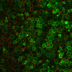 Virus XXX - Unknown Green Viruses