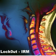 Lock0ut - IRM