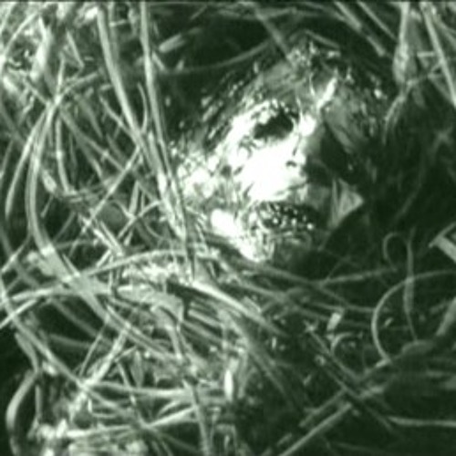 The Experimental Surgical Removal of a Psychic Tumor